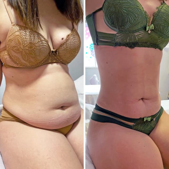 Resultado antes e depois 1