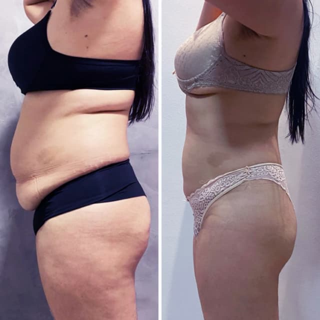 Resultado antes e depois 2