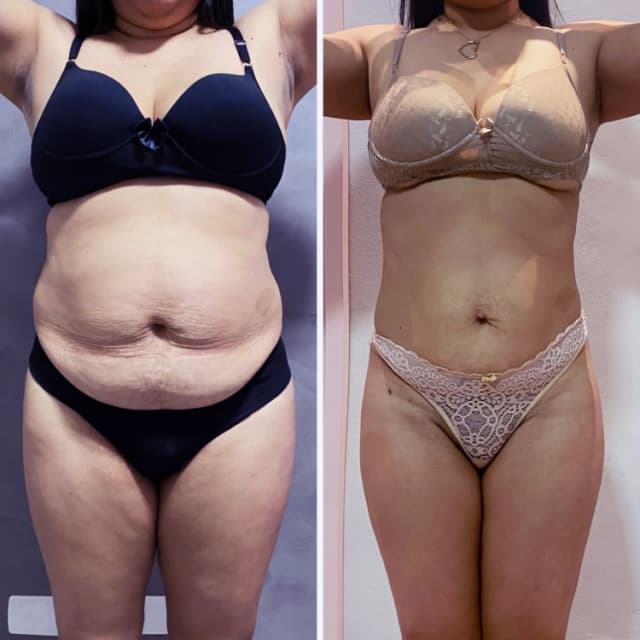 Resultado antes e depois 3