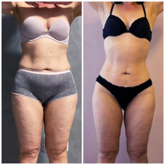 Resultado antes e depois 5