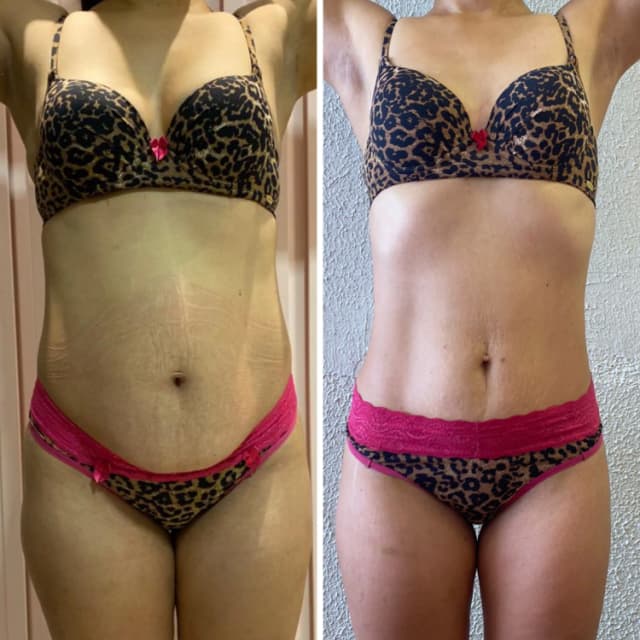 Resultado antes e depois 6